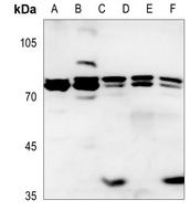 Anti-ITPKB Antibody