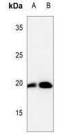 CFL1 (phospho-S3) antibody