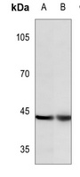c-Jun (phospho-Y170) antibody