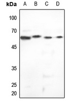 Anti-Cytokeratin 5 Antibody