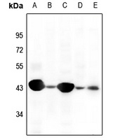 Anti-Cytokeratin 19 Antibody