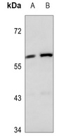 KRT84 antibody