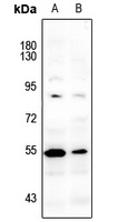 Anti-LCK (Phospho-Y393) Antibody