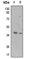LGALS9 antibody