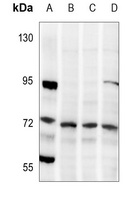 Anti-LIMK1/2 (Phospho-T508/505) Antibody
