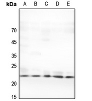 LTA antibody