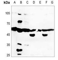 Anti-LTBR Antibody