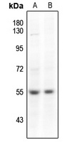 SMAD3 (phospho-S204) antibody