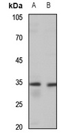 MAGEA6 antibody