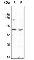 Tau antibody