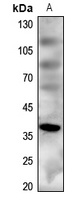 MC4R antibody