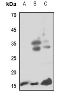 Anti-Midkine Antibody