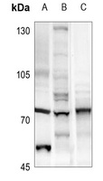 MEN1 antibody