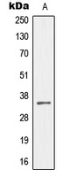 Anti-MEOX2 Antibody