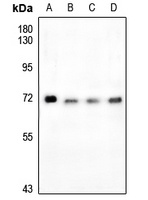 Anti-FOXO4 (Phospho-S197) Antibody
