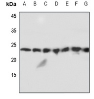 Anti-MMP1 22k Antibody