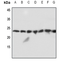 MMP1 antibody