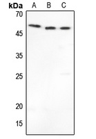Anti-MMP1 Antibody