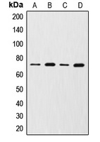 Anti-MMP2 Antibody
