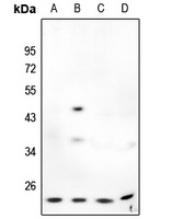 Anti-MMP7 Antibody