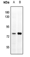 Anti-MMP9 Antibody