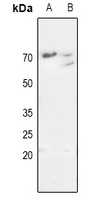 Anti-MMP11 Antibody