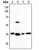 Anti-MMP13 Antibody