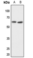 Anti-MMP14 Antibody