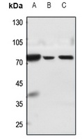 MMP15 antibody