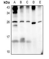 Anti-ATP6 Antibody