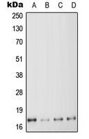 Anti-MYL6 Antibody