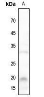Anti-NBL1 Antibody