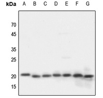 NDUFA8 antibody