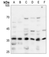 Anti-NDUFA9 Antibody