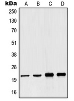 Anti-NDUFB10 Antibody