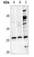 NDUFV2 antibody