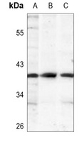 Anti-IKB alpha (Phospho-S32/S36) Antibody