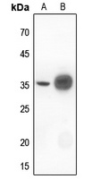 NFKBIA antibody