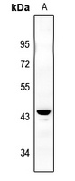 Anti-IKB beta (Phospho-S23) Antibody