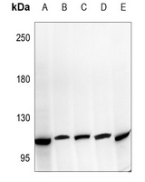 NOTCH2 antibody