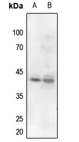 Nucleophosmin (phospho-T199) antibody