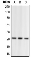 Anti-NRL Antibody