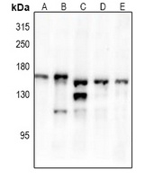 Anti-TRK B (Phospho-Y516) Antibody