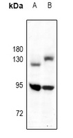 TrkB antibody