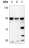 Anti-NVL Antibody