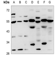 Anti-P2X1 Antibody