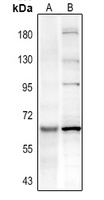 PAK3 (phospho-S154) antibody
