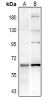Anti-PAK3 (Phospho-S154) Antibody