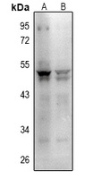 PD1 antibody