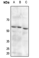 PDPK1 (phospho-S241) antibody
